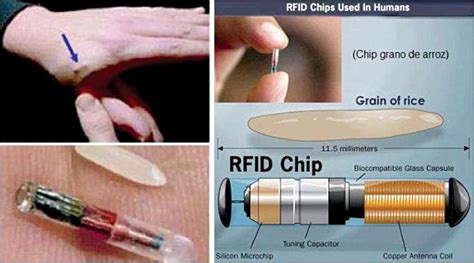 rfid chip sets|rfid for personal use.